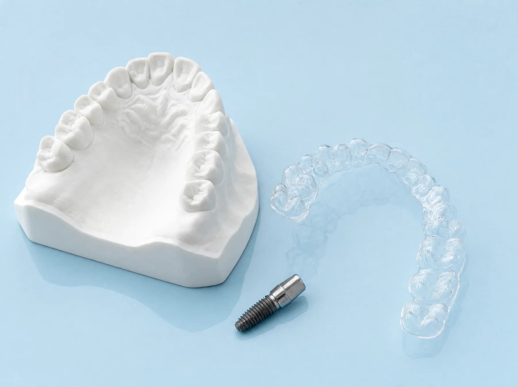 Modelo odontológico e alinhador ilustrativos